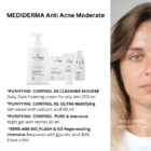 Mediderma Ritual Ten gras Acnee shop cronos med
